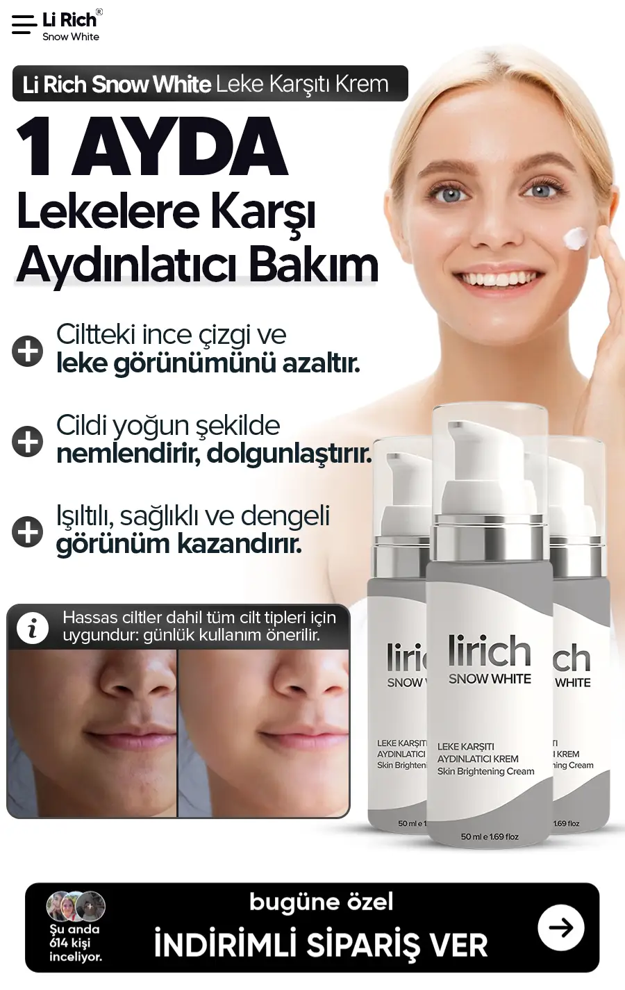 Leke Kremi
