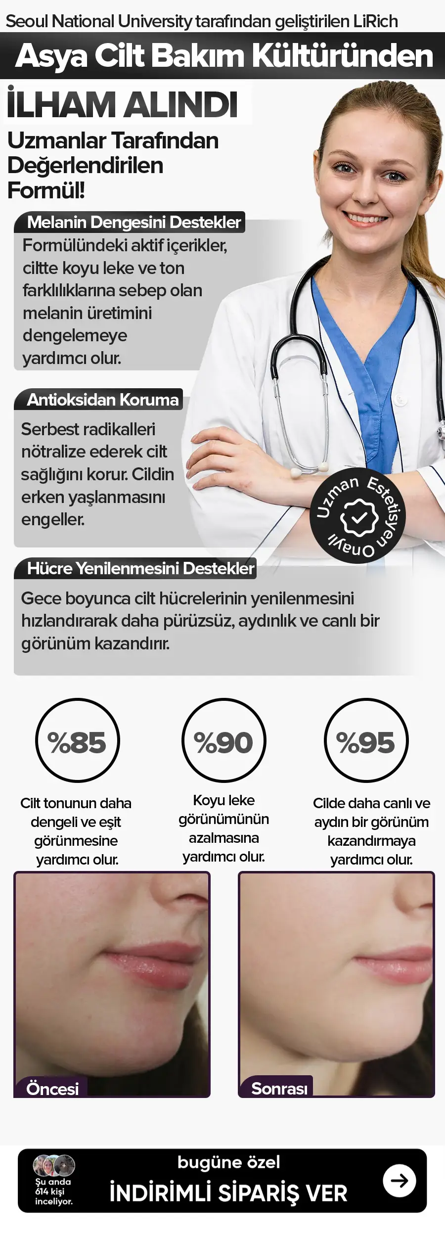 Leke Kremi
