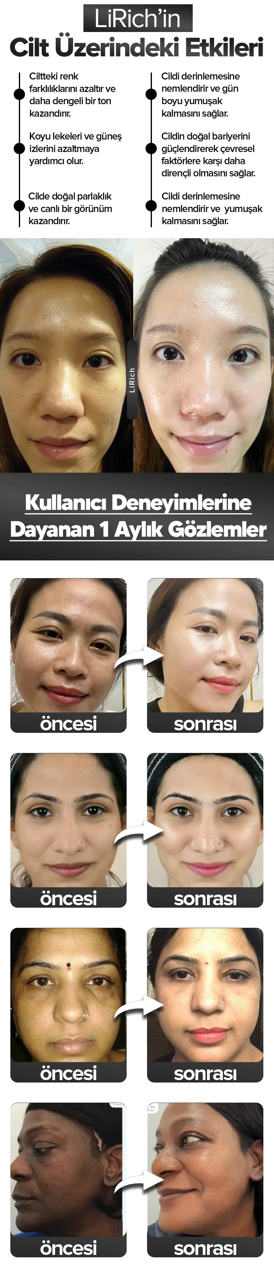 Leke Kremi